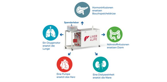 리버포라이프가 만든 간 치료 기계. 신체의 장기들이 구현돼 이곳에서 간이 3-7일 간 생존할 수 있다. (출처: USZ) 