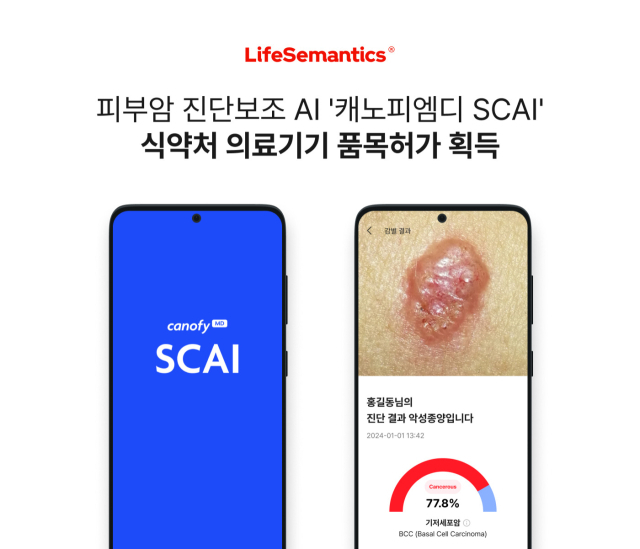 캐노피엠디 SCAI (ⓒ 라이프시맨틱스)